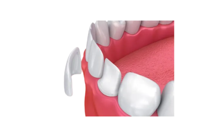 Espejo dental