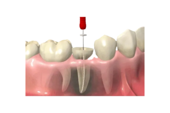 Espejo dental