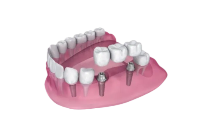 Espejo dental