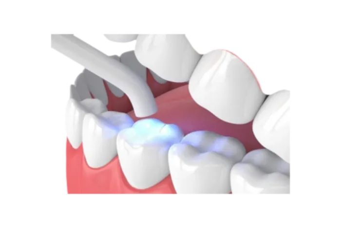 Espejo dental